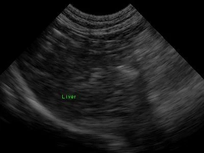 Liver